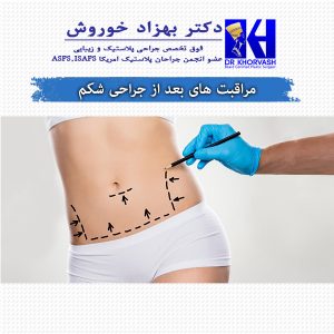 مراقبت های بعد از جراحی شکم - دکتر خوروش