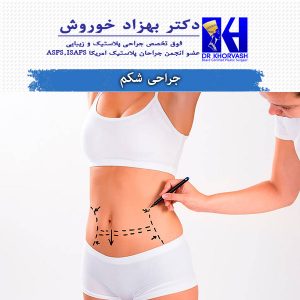 جراحی شکم - دکتر خوروش