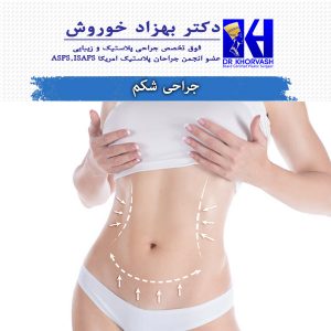 جراحی شکم - دکتر خوروش