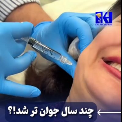 تزریق بوتاکس - دکتر خوروش - drkhorvash.com