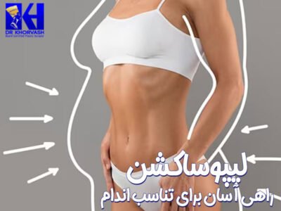 لیپوساکشن - دکتر خوروش-drkhorvash.com