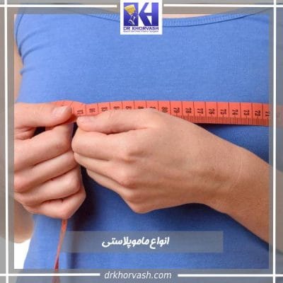 انواع روشهای ماموپلاستی-دکتر خوروش- drkhorvash.com