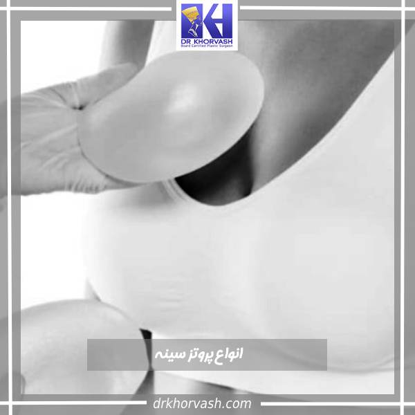 انواع پروتز سینه