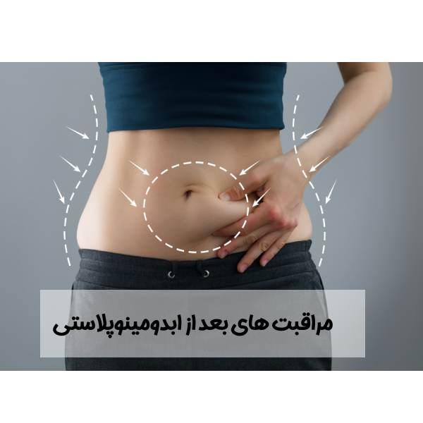 مراقبت های بعد از ابدومینوپلاستی