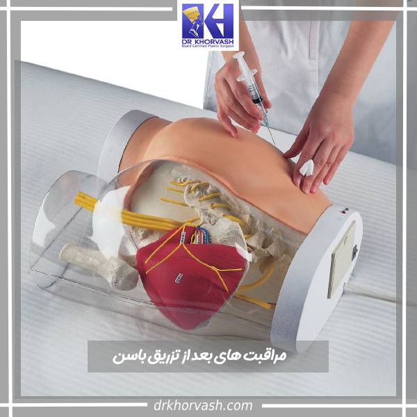 مراقبت های بعد از تزریق باسن