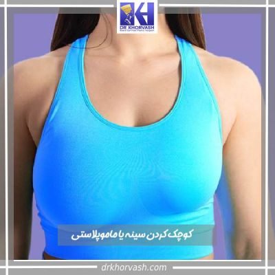 عمل کوچک کردن سینه- دکتر بهزاد خوروش-drkhorvash.com