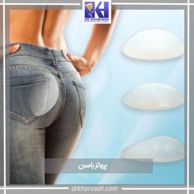 عکس پروتز باسن- دکتر بهزاد خوروش- drkhorvash.com