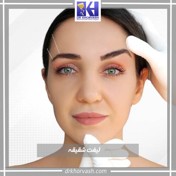 عکس لیفت شقیقه