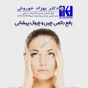 لیفت پیشانی در تهران _ دکتر بهزاد خوروش
