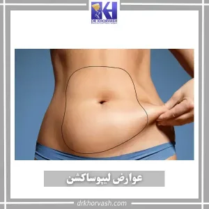 عوارض لیپوساکشن _ دکتر بهزاد خوروش