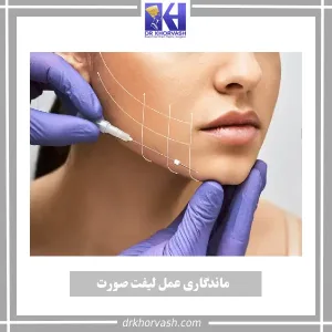 ماندگاری عمل لیفت صورت _ دکتر بهزاد خوروش