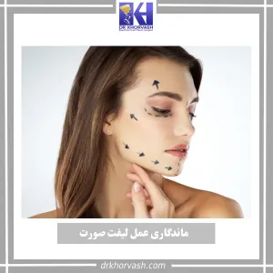 ماندگاری جراحی لیفت صورت _ دکتر بهزاد خوروش
