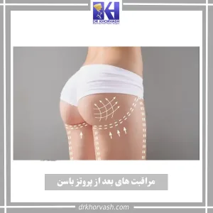 مراقبت های بعد از پروتز باسن _ دکتر بهزاد خوروش