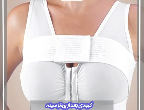 کبودی بعد از پروتز سینه | راه های رفع کبودی