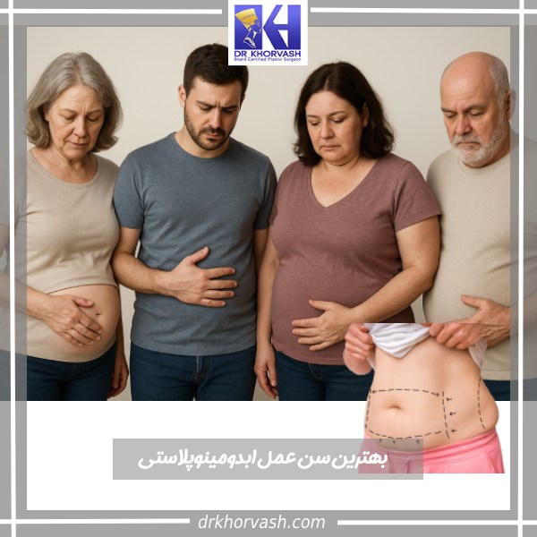 بهترین سن ابدومینوپلاستی